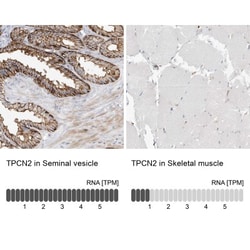Two pore calcium channel protein 2 Antibody, Novus Biologicals 0.1mL; Unlabeled:Antibodies,
